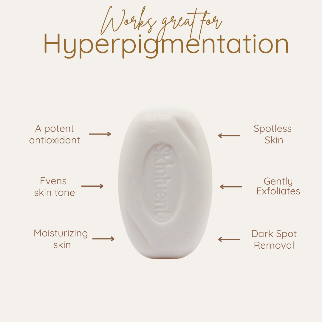 Skinluent Glutathione White bar of soap with text highlighting its benefits for hyperpigmentation on a beige background