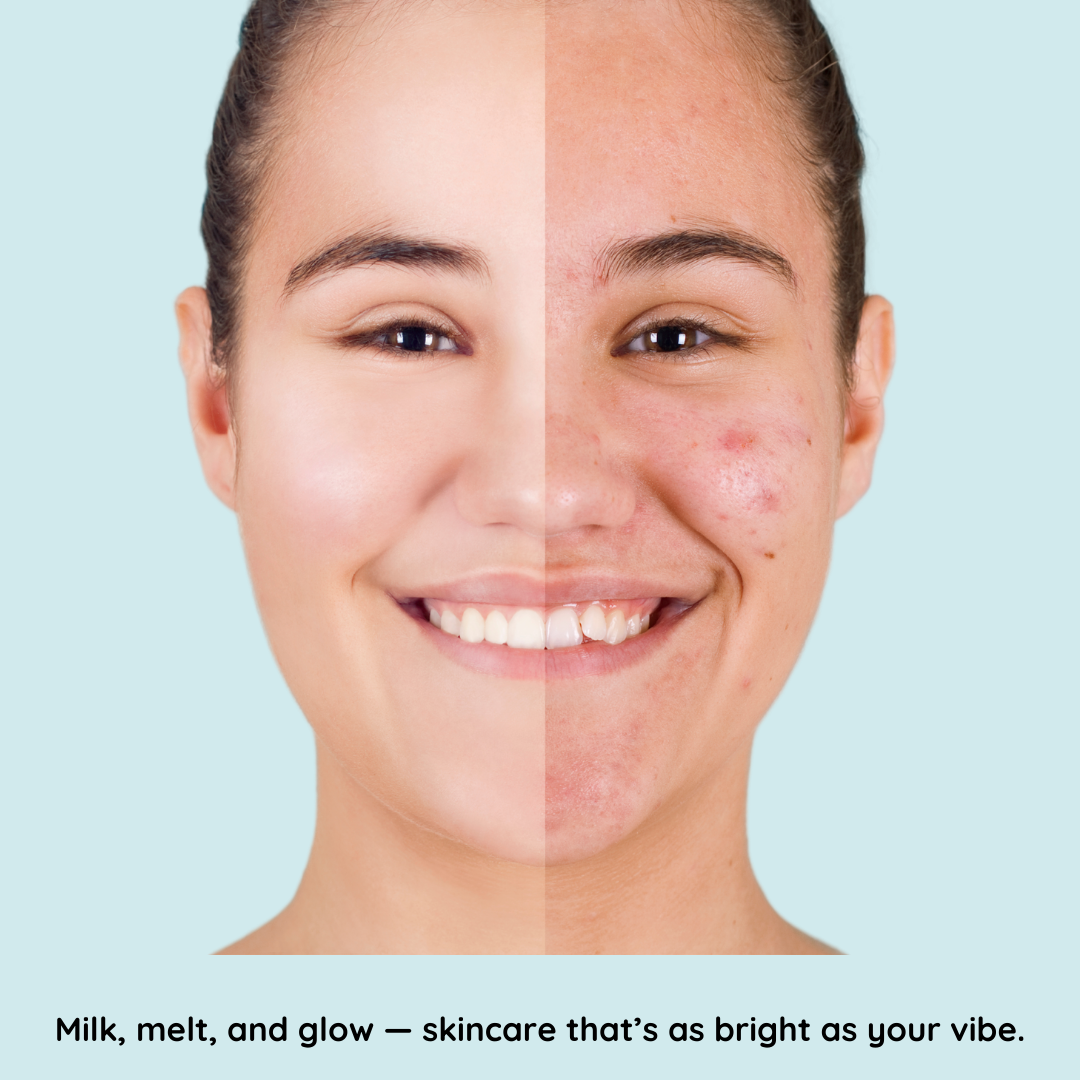 Before and after skincare comparison on a light blue background
