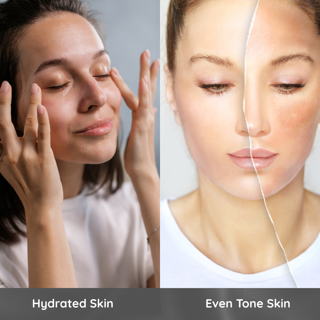 Before and after comparison of hydrated and even-toned skin on a woman.